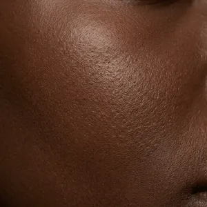Healthy dark skin texture