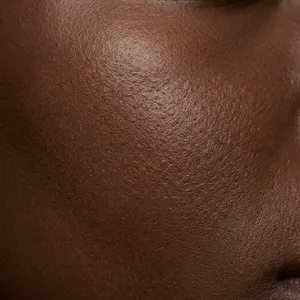Healthy dark skin texture
