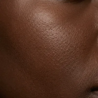 Healthy dark skin texture