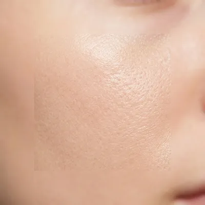 Healthy light skin texture