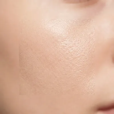 Healthy light skin texture