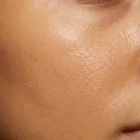 Healthy medium skin texture